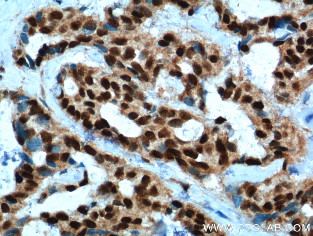 PYGO2 Polyclonal antibody