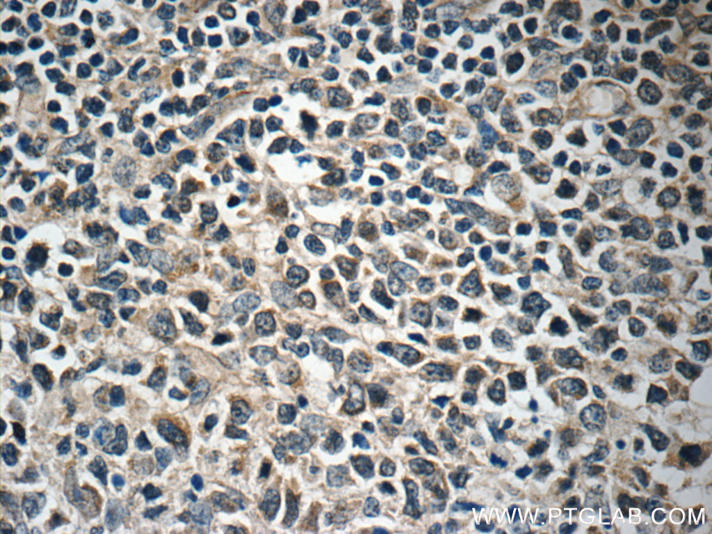 FBXL18 Polyclonal antibody