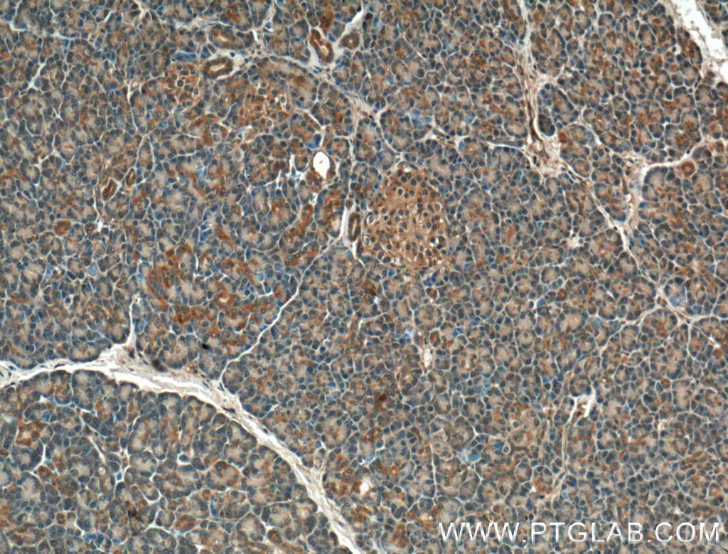 GTPBP2 Polyclonal antibody