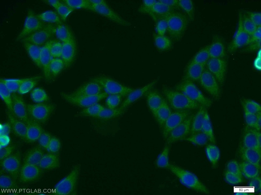 BMSC UbP Polyclonal antibody