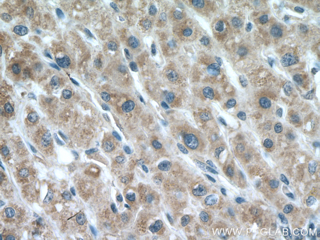 LIAS Polyclonal antibody