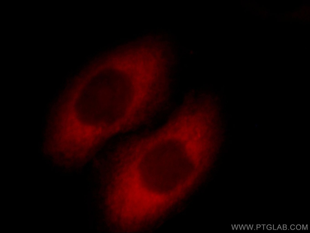 SCIN Polyclonal antibody