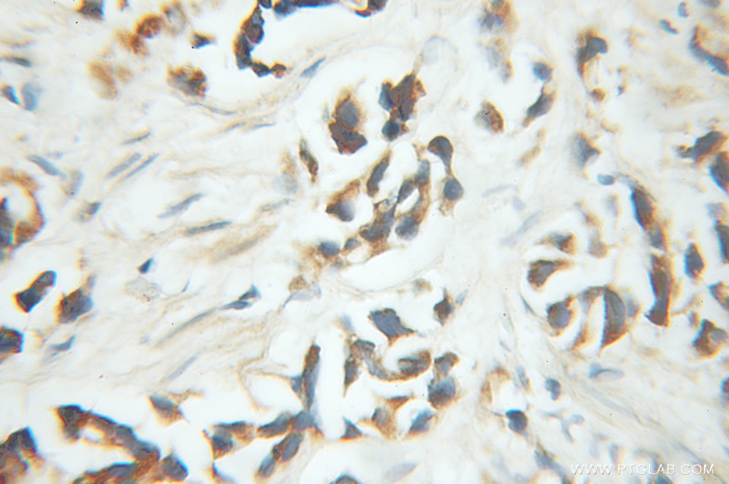 PNKD Polyclonal antibody