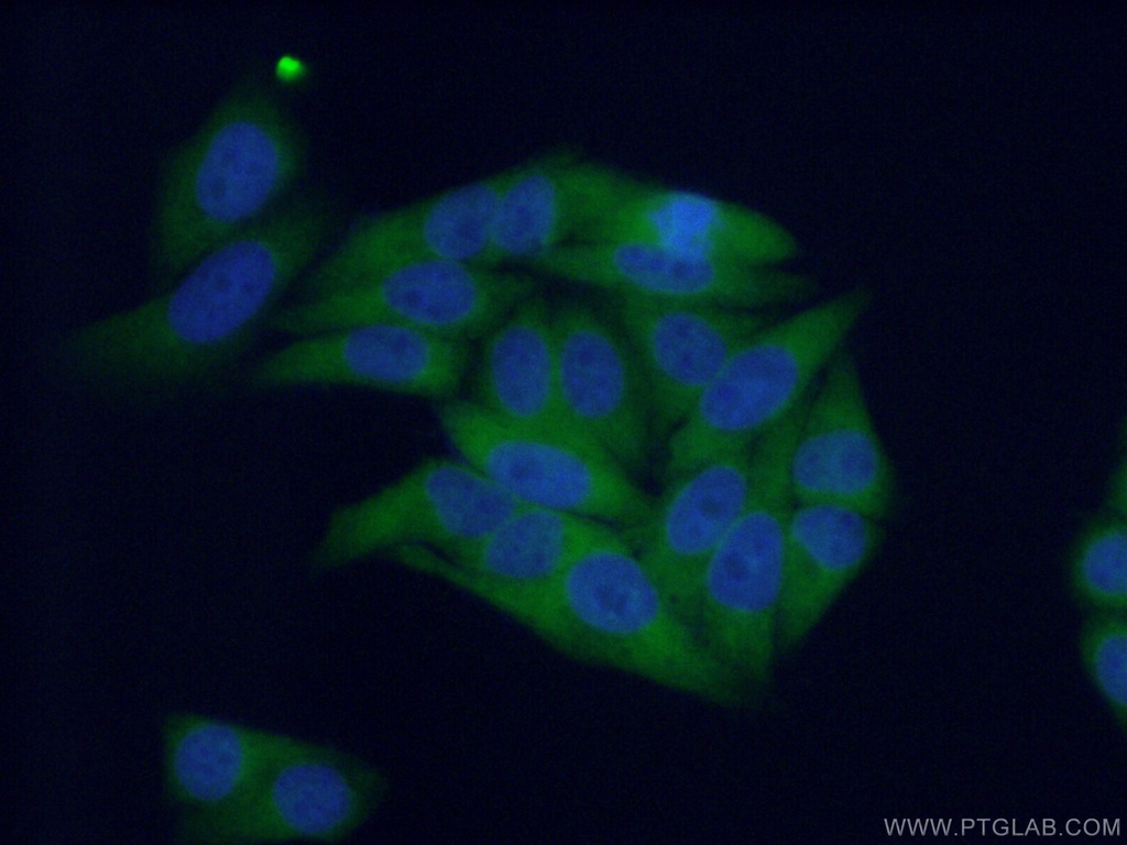 SRP68 Polyclonal antibody