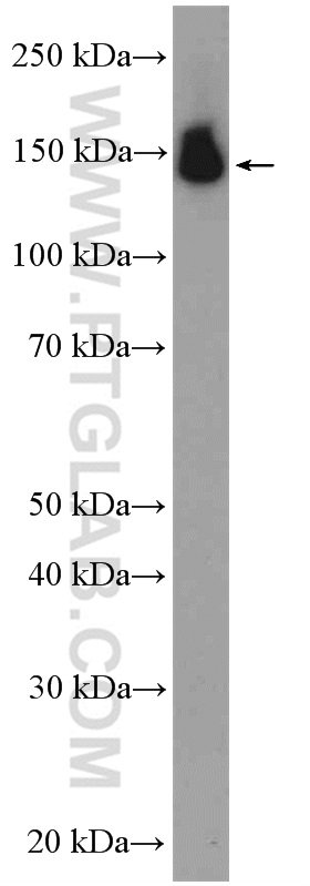 PUM2 Polyclonal antibody