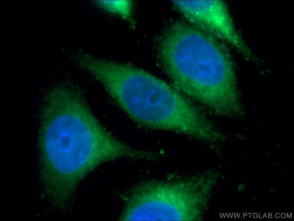 IFI30 Polyclonal antibody