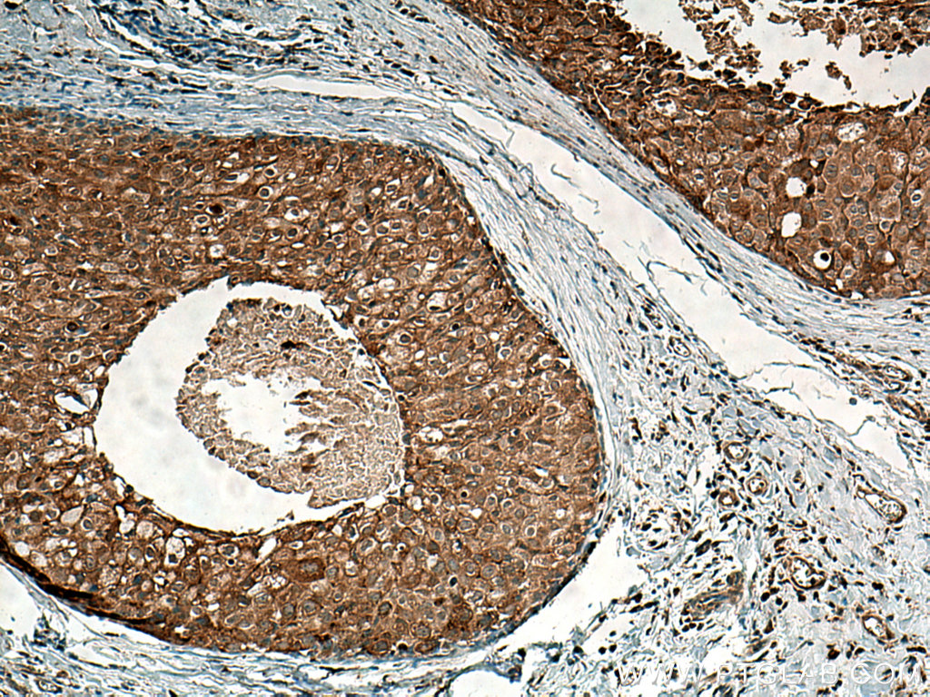 SURF4 Polyclonal antibody