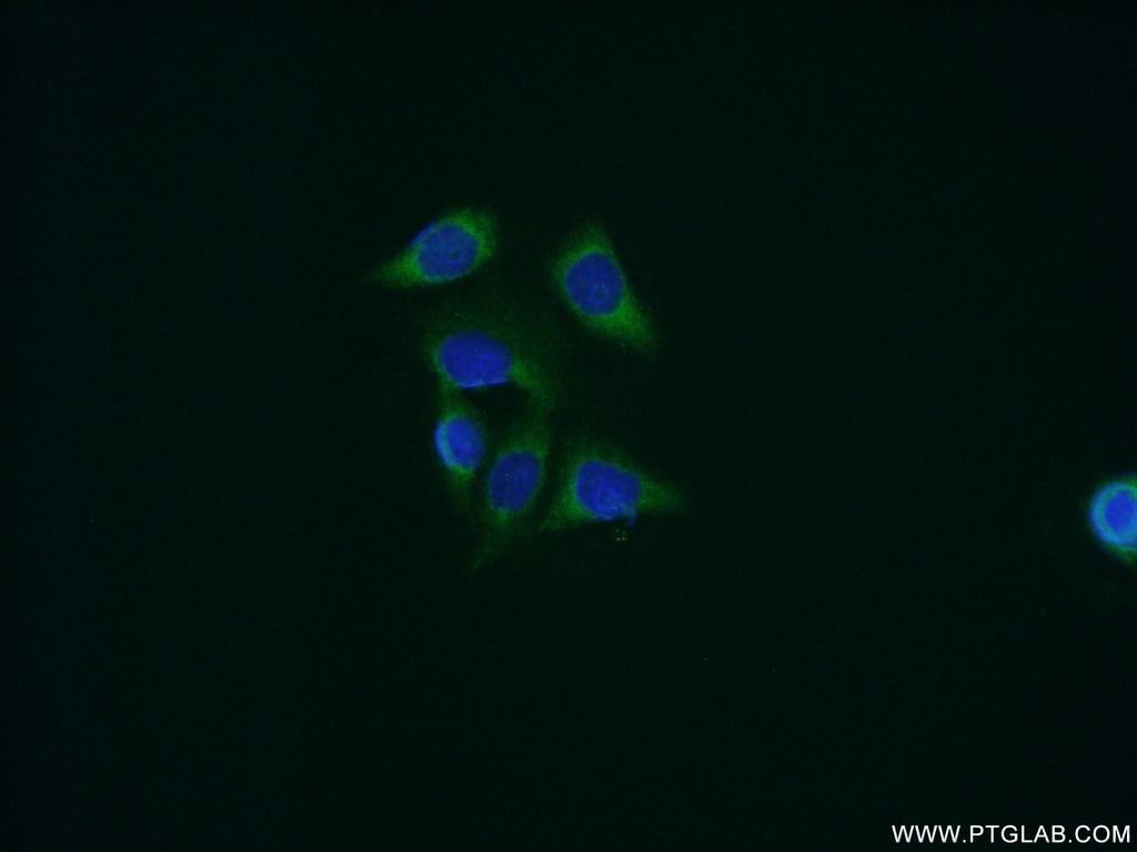 Cyclophilin B Polyclonal antibody