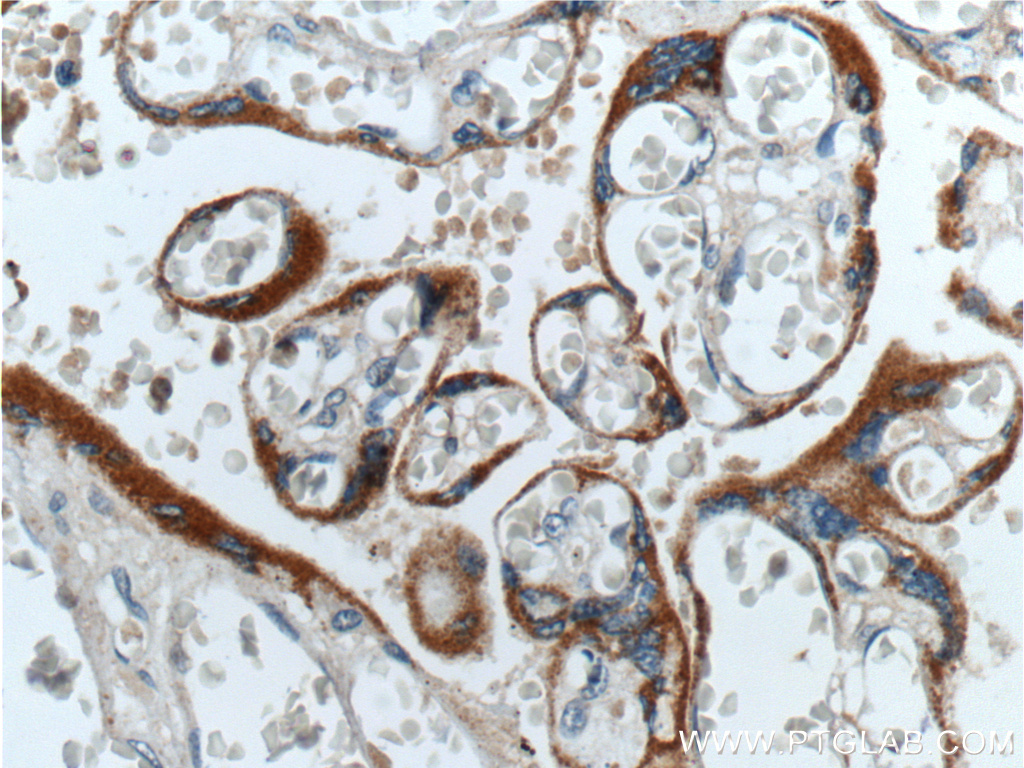 hCG Beta Polyclonal antibody