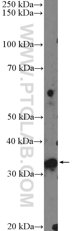 FTSJ1 Polyclonal antibody