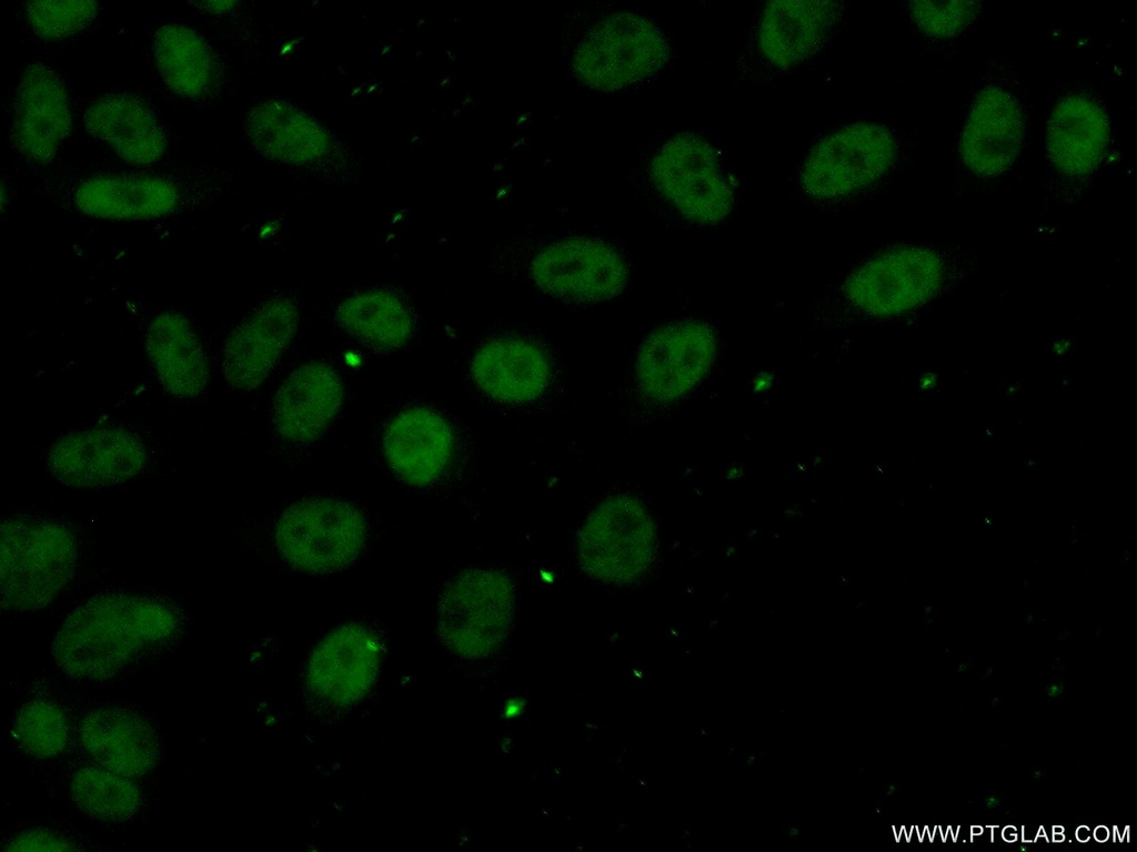 DNTTIP1 Polyclonal antibody