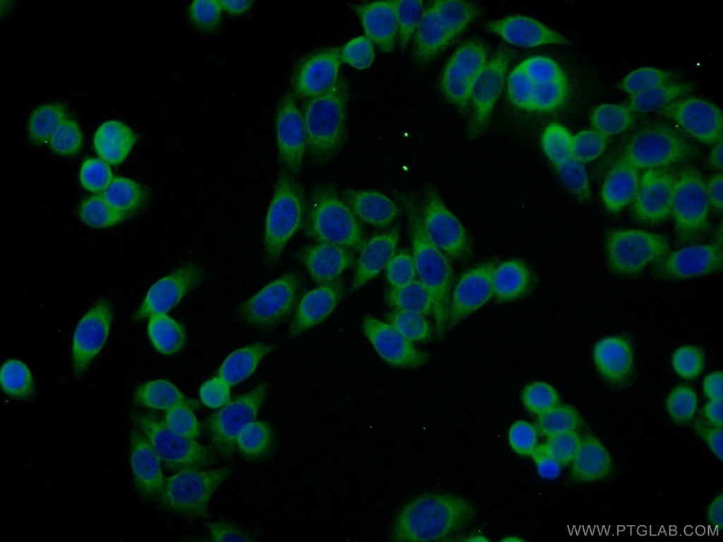 SSR4 Polyclonal antibody