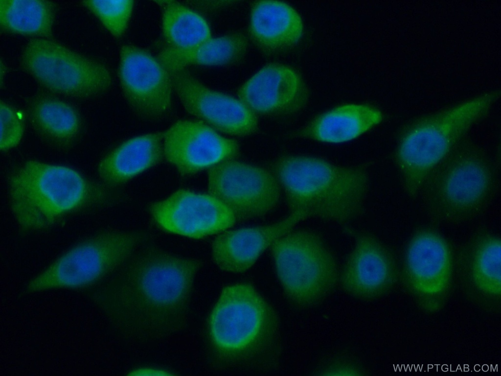 SUGT1 Polyclonal antibody