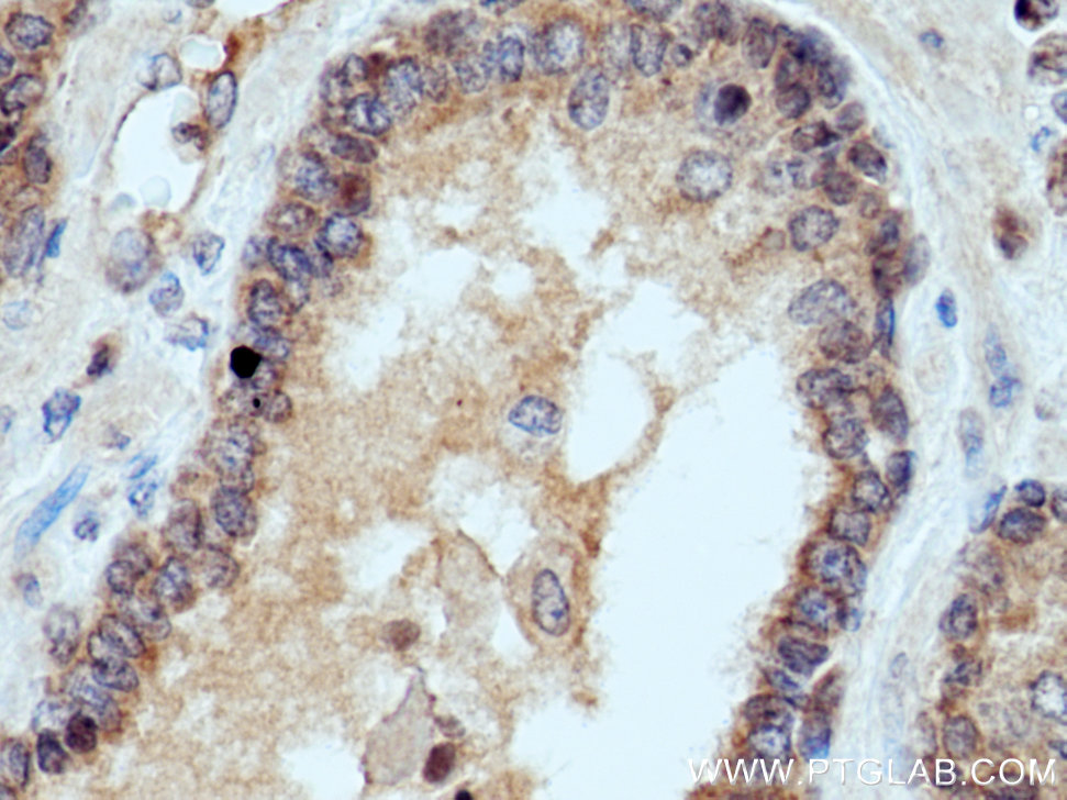 UBE2D1/2/3/4 Polyclonal antibody
