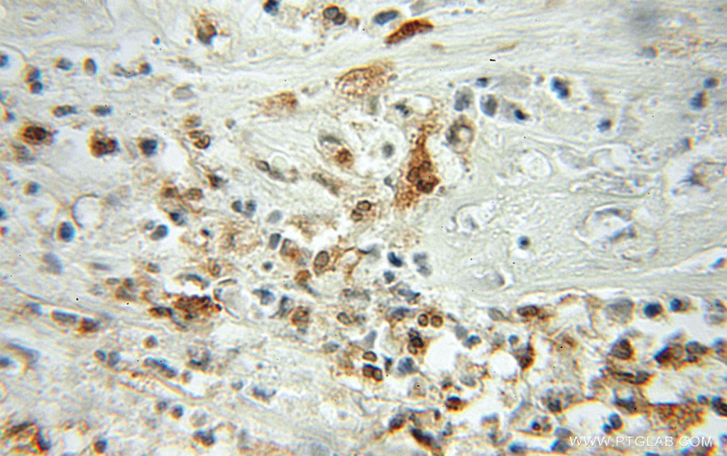 Profilin 1 Polyclonal antibody
