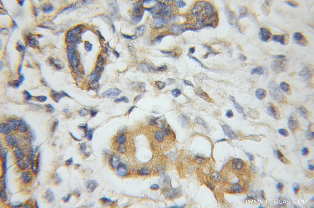 PLEK2 Polyclonal antibody