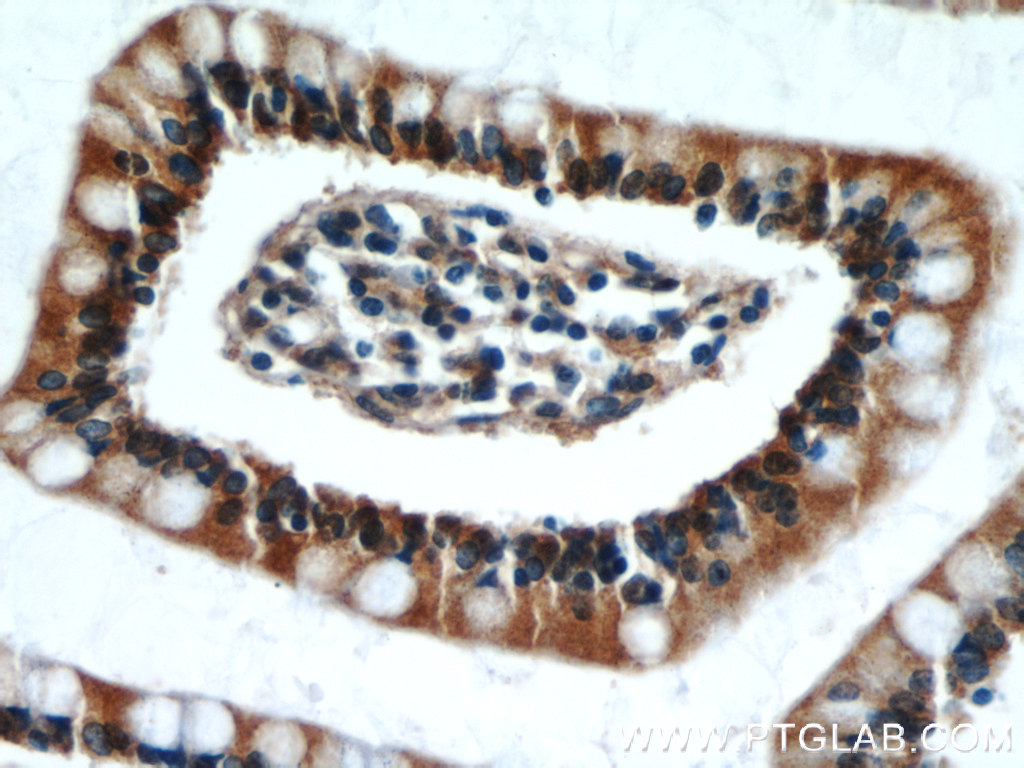 TAX1BP3 Polyclonal antibody
