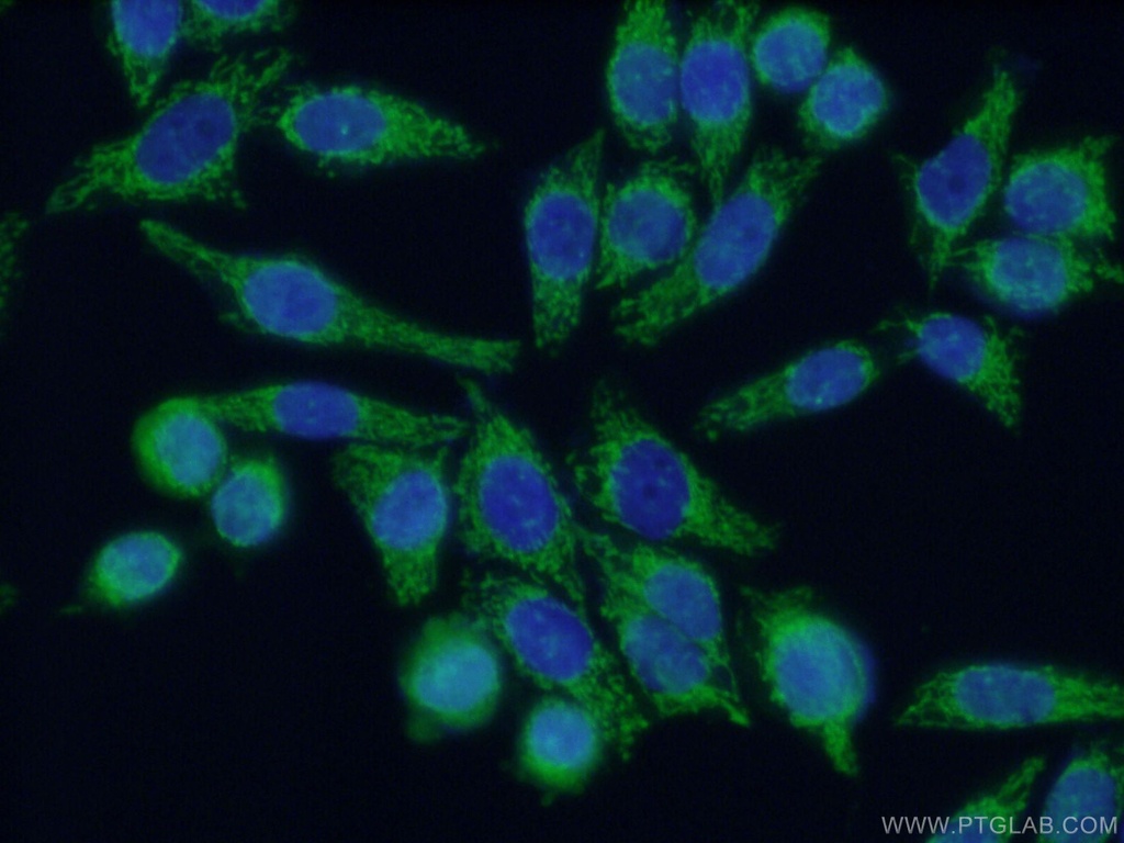 TSFM Polyclonal antibody