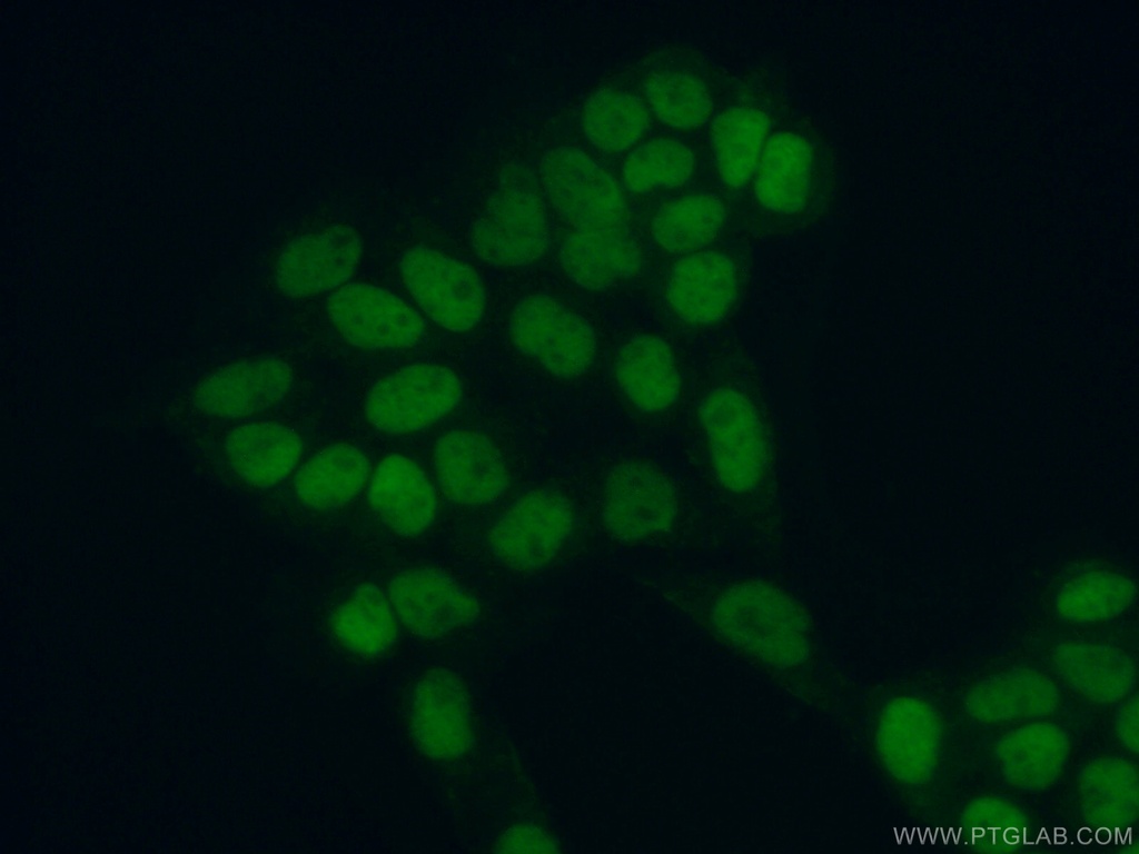 MCM5 Polyclonal antibody