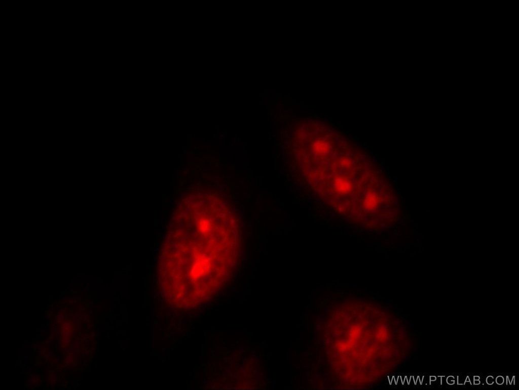 DNAJB6 Polyclonal antibody