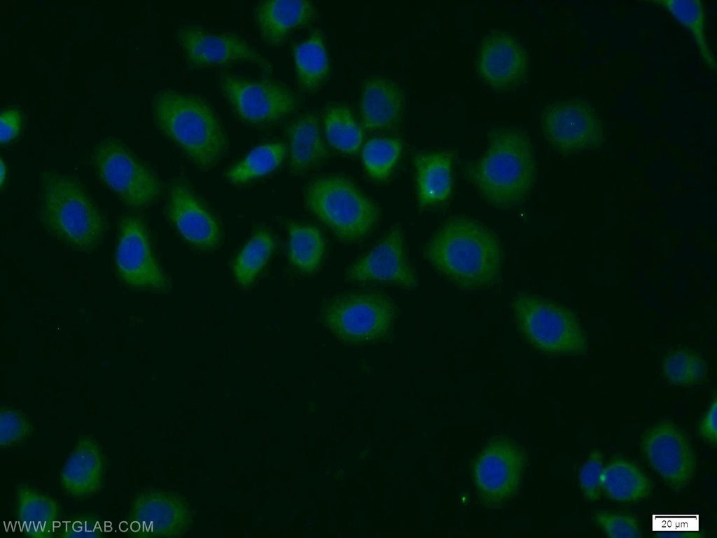CSN1 Polyclonal antibody