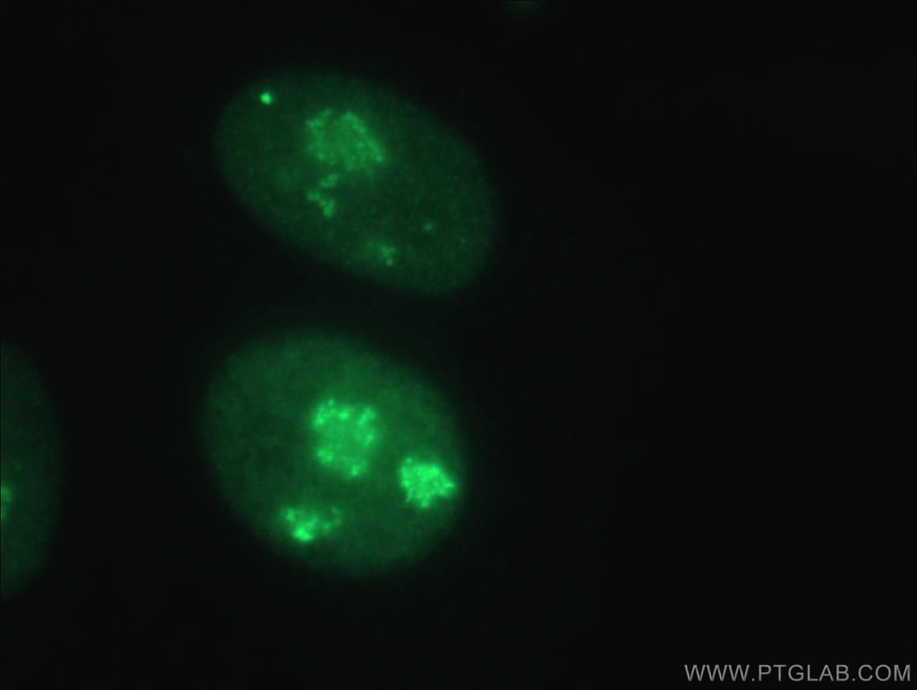 GAR1 Polyclonal antibody