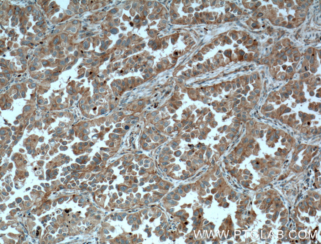 RHOD Polyclonal antibody