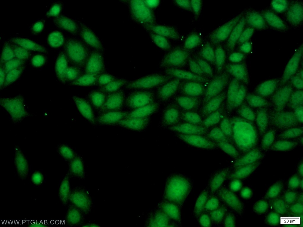 SSB Polyclonal antibody