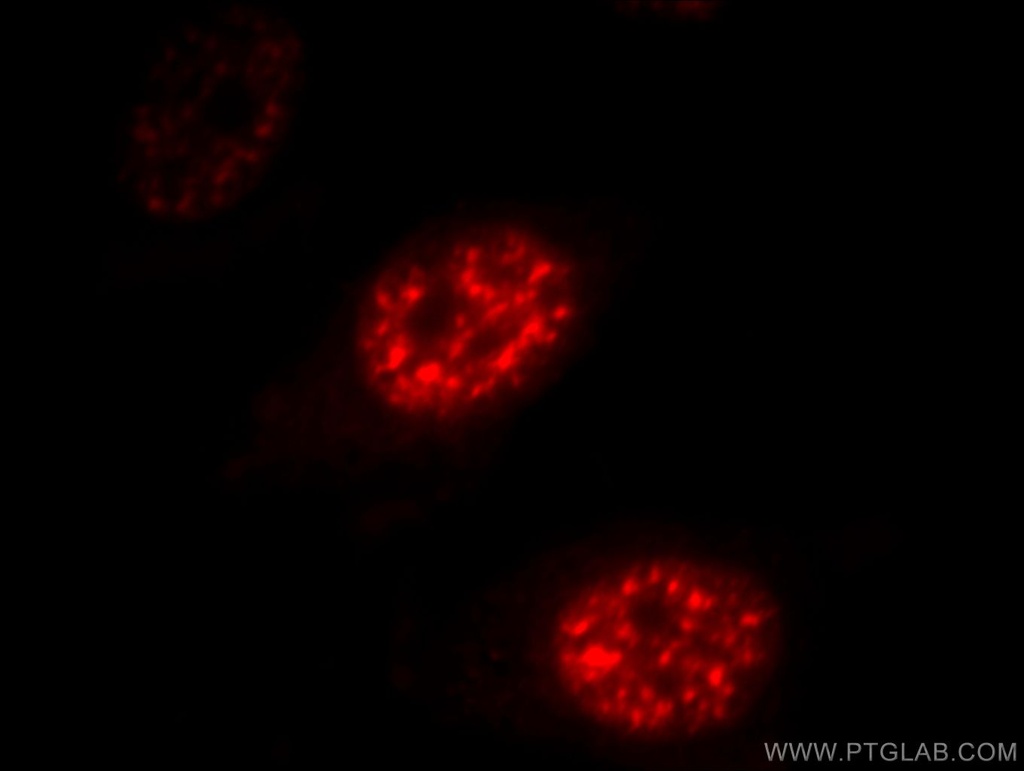 DDX39A Polyclonal antibody