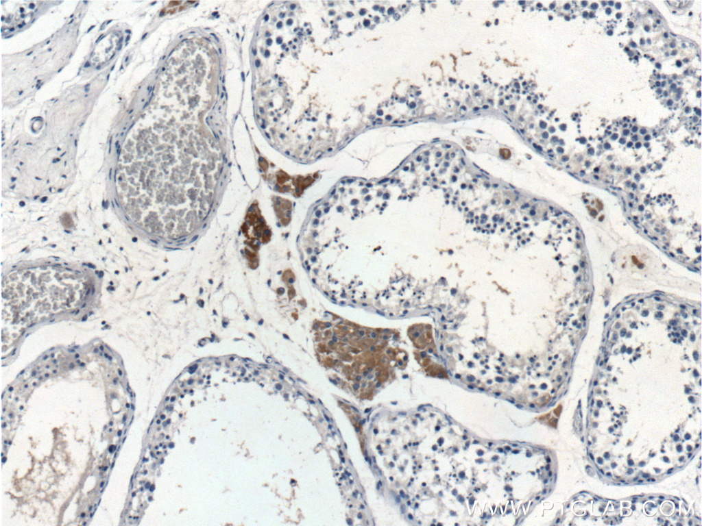SPOCK2 Polyclonal antibody