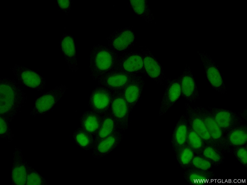 RAD1 Polyclonal antibody