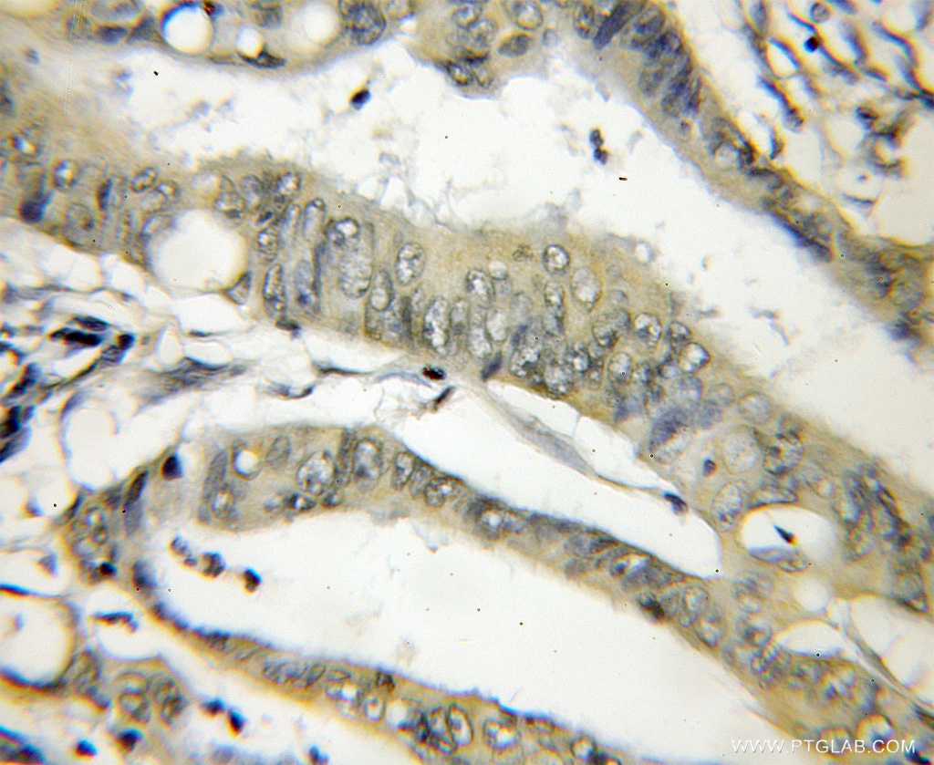 THOP1 Polyclonal antibody