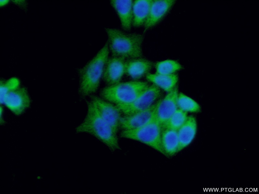 BCL7B Polyclonal antibody