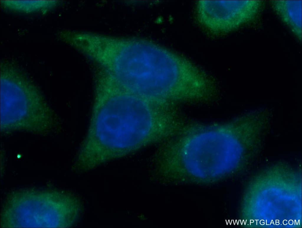 SPRR3 Polyclonal antibody