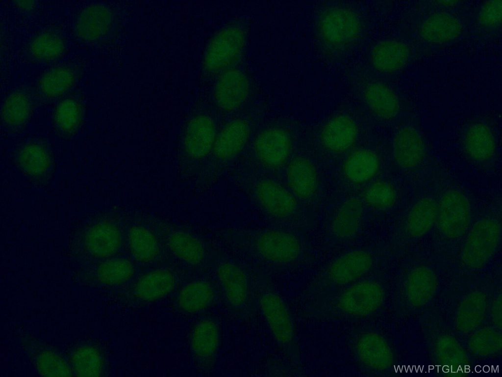 HBP1 Polyclonal antibody