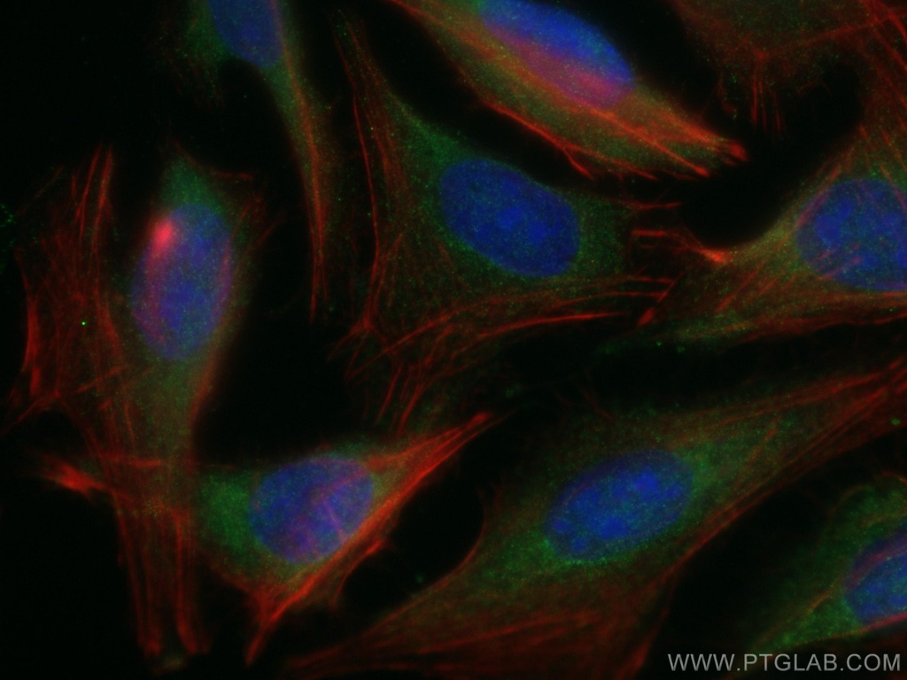 PSMB1 Polyclonal antibody