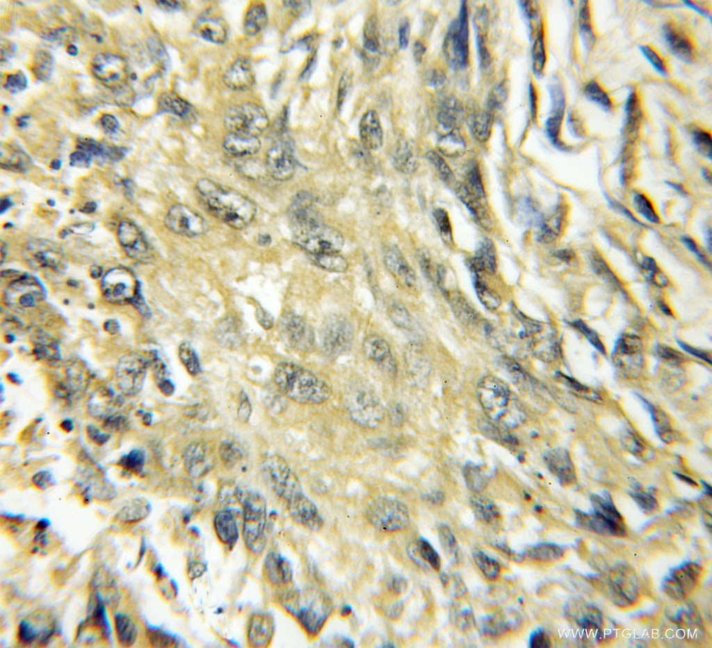 CYP4B1 Polyclonal antibody