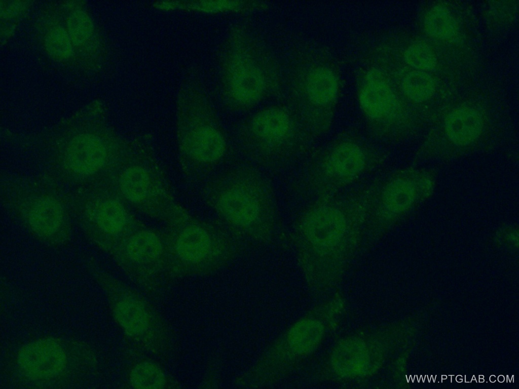 PRIM2 Polyclonal antibody
