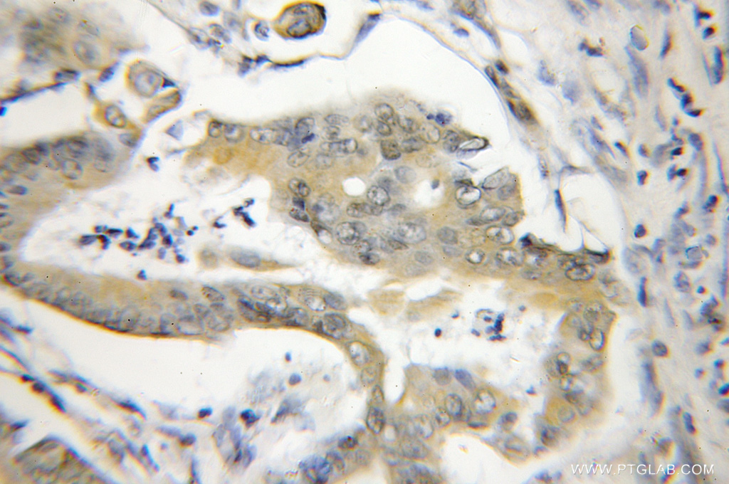 NA14 Polyclonal antibody