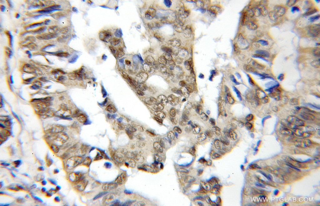BUD31 Polyclonal antibody