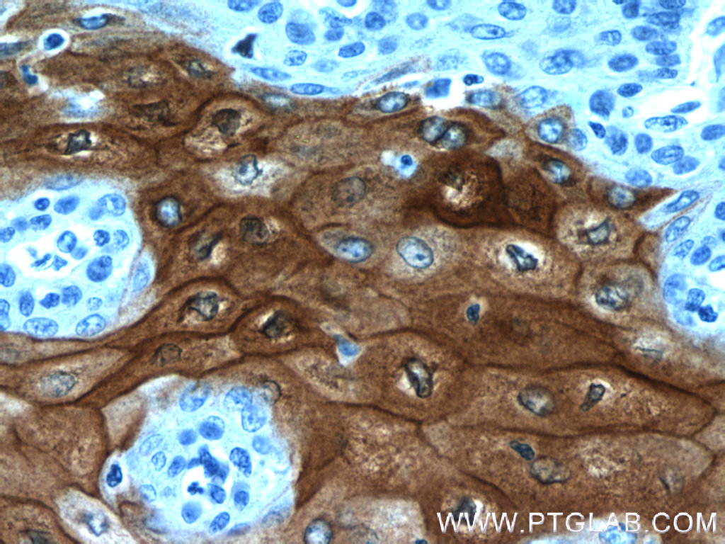 CRNN Polyclonal antibody