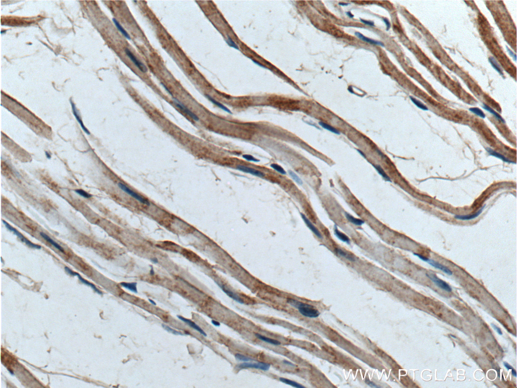 POPDC3 Polyclonal antibody