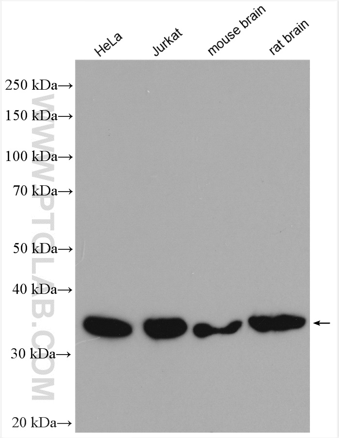 RABGGTB Polyclonal antibody