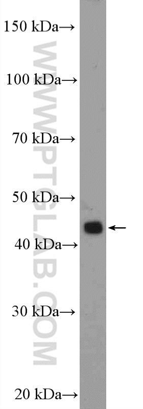 SIRP Beta 1 Polyclonal antibody