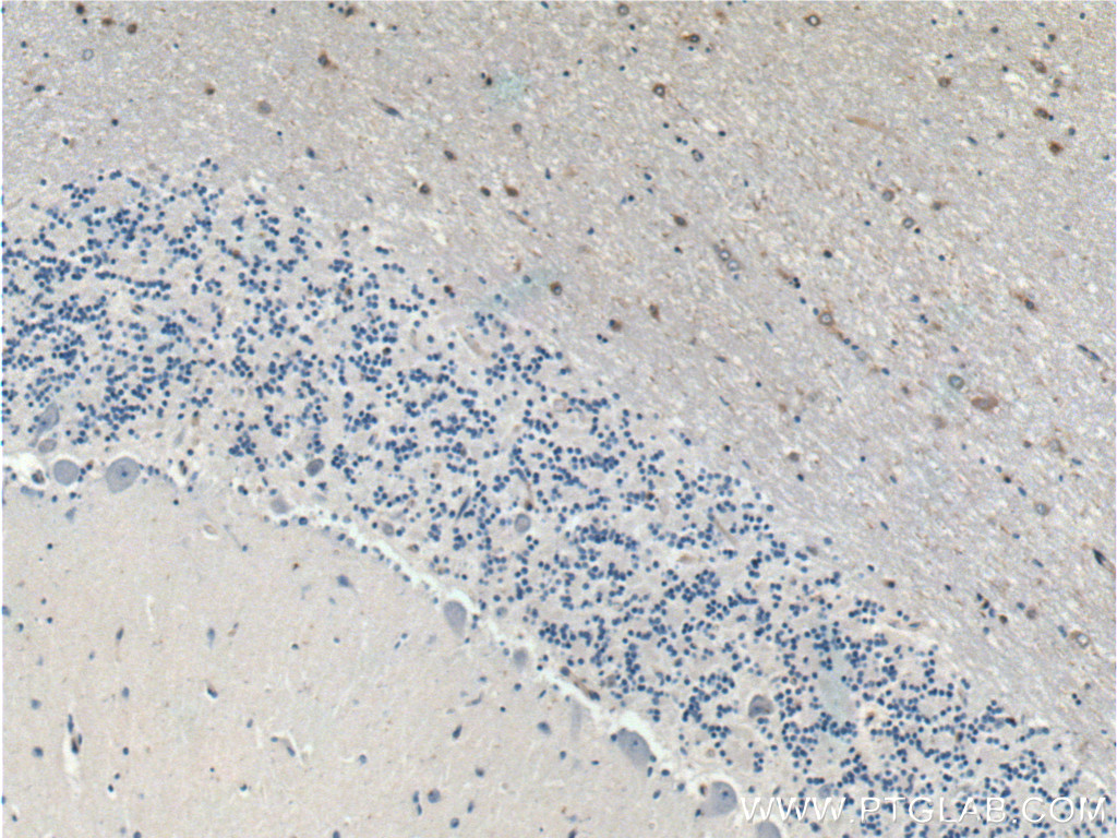 ARPP-21 Polyclonal antibody