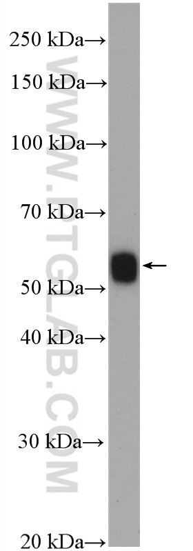 HLA-DMA Polyclonal antibody