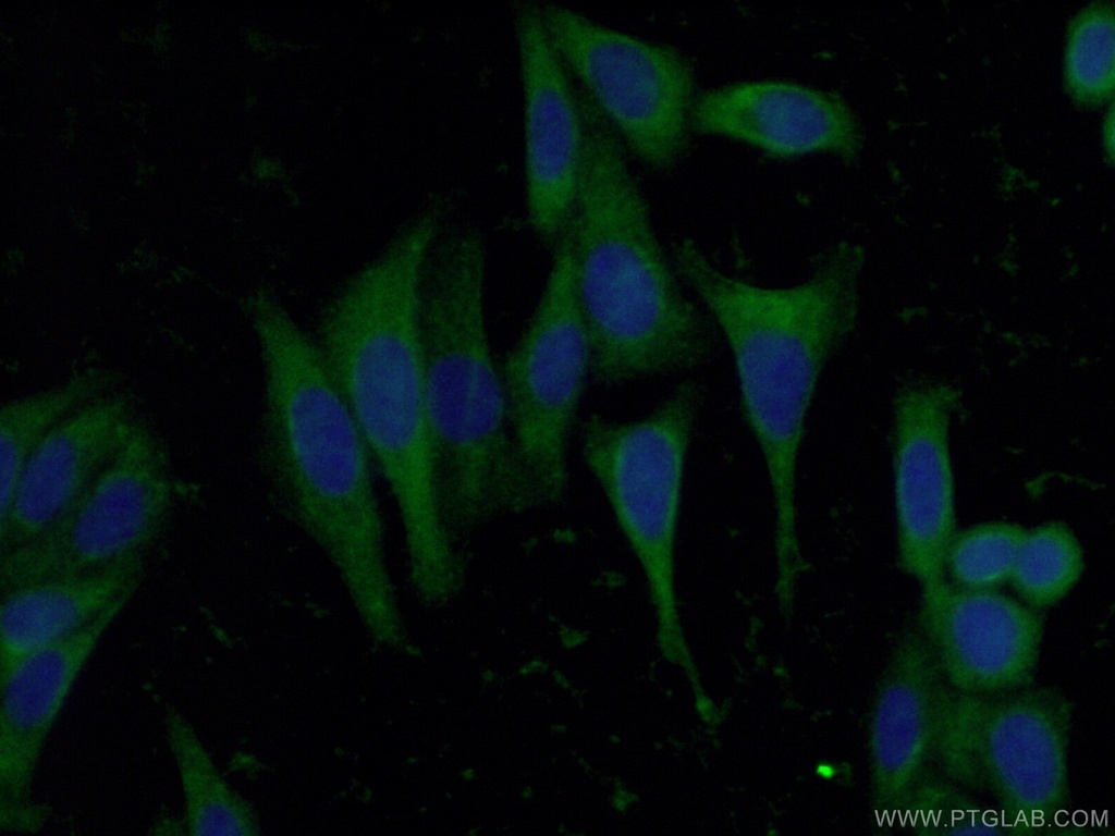 RBP5 Polyclonal antibody