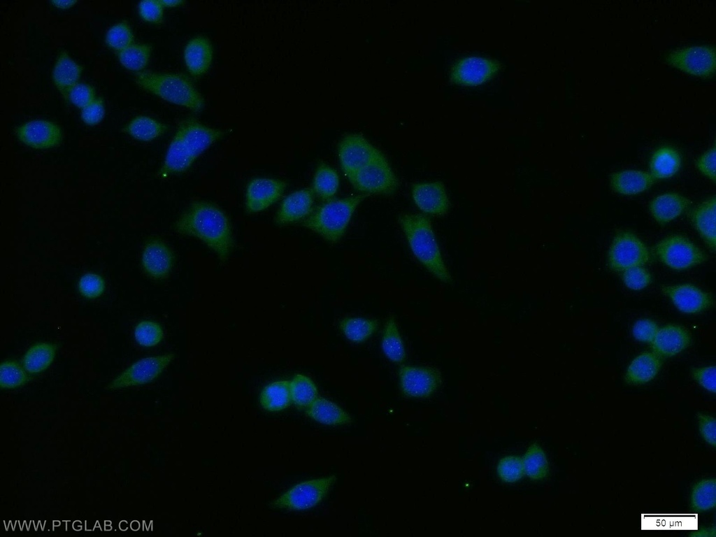 SPCS1 Polyclonal antibody