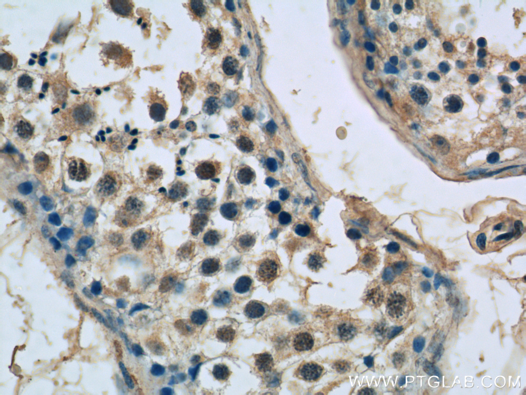 SPATA6 Polyclonal antibody