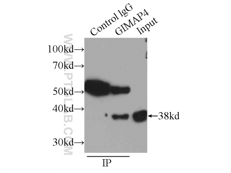 GIMAP4 Polyclonal antibody